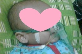 Ususnya Terlilit, Bayi 4 Bulan di Makassar Ini Butuh Uluran Tangan untuk Operasi
