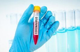 Hasil Swab Pertama dan Kedua Positif, Tiga Orang di Wajo Terpapar Virus Corona