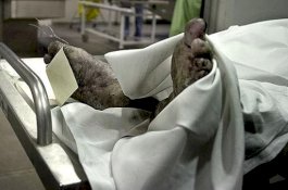 Tega Sembunyikan Jasad Nenek di Kulkas selama 16 Tahun demi Dana Bansos