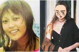 Wu Xiaochen Ratusan Kali Oplas Sejak Usia 14 Tahun, Hasilnya Bikin Tercengang