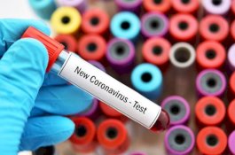 Pakar Epidemiologi Prediksi Pekan Depan Pasian Covid-19 di Indonesia Mencapai 1.400 per Hari