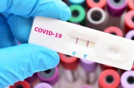 Studi Menunjukkan Virus Corona Sudah Semakin Melemah