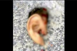 Ditinggal 3 Malam, Suami Iris Telinga Istri hingga Copot