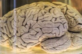 Studi: Covid-19 Bisa Merusak Otak