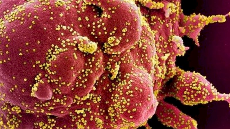 Pemindaian sel apoptosis berwarna merah yang sangat terinfeksi virus SARS-CoV-2 berwarna kuning. Virus SARS-CoV-2 menyebabkan COVID-19. (Handout: NIAID via AFP)