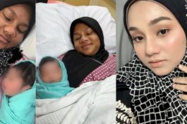 Teman Tak Mengenalinya, Wajah Mamah Muda Ini Berubah Hitam Setelah 2 Kali Hamil