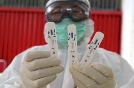 Oknum Perawat dan Staf RS Ditangkap karena Palsukan Hasil Tes Covid-19