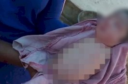 Dokter Pastikan Normal, Tapi Pas Lahir Bayi Ini Tak Punya Kaki dan Tangan