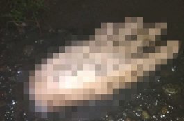 Dibakar Rasa Cemburu, Suami Bacok Istri hingga Tangan Putus