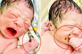 Benar-benar Ada, Bayi Ini Lahir dengan Menggenggam Alat Kontrasepsi