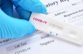 Mulai Besok, Pemkab Bulukumba Gelar Rapid Test Covid-19 Gratis