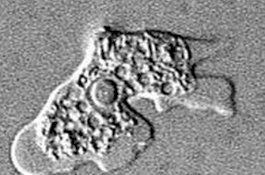 Amoeba Pemakan Otak Ditemukan, Pasien Bisa Meninggal dalam Sepekan