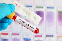 Ikut Edaran Kemenkes, Tarif Rapid Test Covid-19 di RSUD Andi Makkasau Parepare Rp150 Ribu