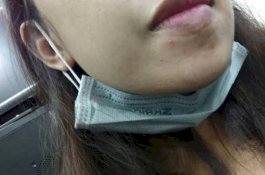 Jangan Turunkan Masker ke Dagu, Termasuk saat Makan