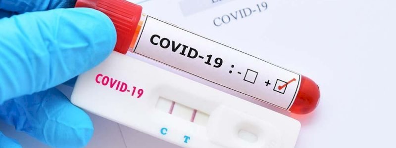 Waspada! COVID-19 Varian XBB Terdeteksi di Indonesia
