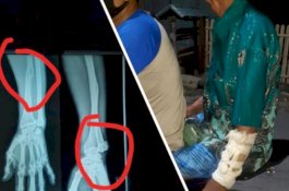 Pukul Pamannya, Adik Anggota DPRD Jeneponto Resmi Tersangka