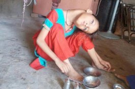 Terjatuh saat Bermain, Leher Gadis Ini Bengkok 90 Derajat