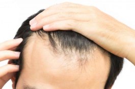 Rambut Rontok Jadi Salah Satu Dampak Covid-19