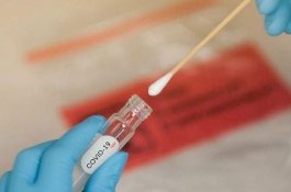 Jangan Main-Main Palsukan Tes Antigen, Pidana 4 Tahun Menanti