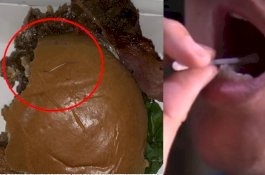 Lidah Pria Ini Terluka Setelah Makan Burger, Pas Dicek Ada Jarum Panjang