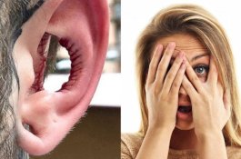 Pria Ini Lubangi Separuh Telinganya dan Memodifikasi Lidah, Katanya Agar Terlihat Keren