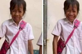 Masih Sekolah Dasar, Bocah Ini Sudah Keriput Seperti Nenek-nenek, Disebut Punya Karma Masa Lalu