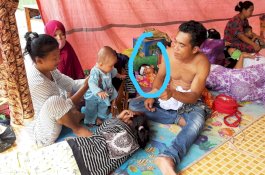 Sakit di Pengungsian, Anak-Anak Mekkatta Dibiarkan Berbaring di Tanah dengan Alas Seadanya