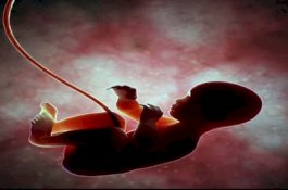 Dinilai sebagai Keputusan Idiot, Polandia Mulai Berlakukan Larangan Aborsi Janin Cacat