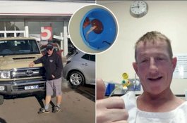 Pengin Beli Mobil Idaman Tapi Tak Punya Uang, Pria Ini Akhirnya Menjual Satu Ginjalnya