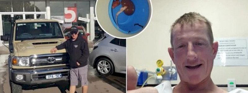 Pengin Beli Mobil Idaman Tapi Tak Punya Uang, Pria Ini Akhirnya Menjual Satu Ginjalnya