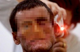 Tak Berani Keluar Rumah, Penduduk di Kota Ini Bisa Mati Bila Kena Sinar Matahari