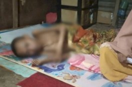 Dapat Kabar Pemuda Lumpuh Layu di Jeneponto, Pemprov Sulsel Gerak Cepat Kirim Bantuan