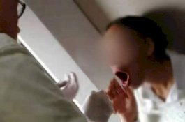 Tertawa Terlalu Berlebihan, Rahang Wanita Ini Bergeser, Mulutnya Tidak Bisa Tertutup Kembali