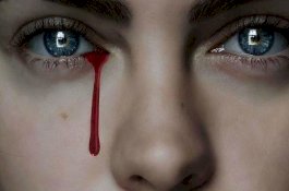 Seram dan Bikin Geger, Perempuan Ini Menangis Darah saat Menstruasi