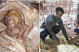 Diyakini Sosok Dewa, Wajah Anak Kambing Ini Mirip Manusia dan Bertahan Hidup 10 Menit Saja