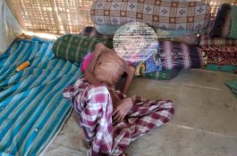 Warga Gizi Buruk Asal Gowa Gawat di Jeneponto, Pak Lurah Urus Surat Pindah agar Bisa Dirawat Maksimal 