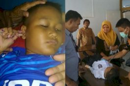 Misterius, Keluar Semut dan Gulungan Kertas dari Telinga Bocah Ini