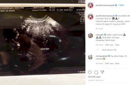 Unggah Hasil USG Isyaratkan Keguguran, Aurel Hermansyah: Selamat Jalan Anakku Sayang