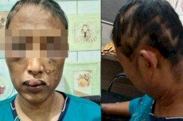 Tuduh Selingkuh, Suami Masukkan Cobek ke Kemaluan Istri, Kepalanya Digunduli