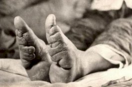 Mengerikan, Praktik Mengecilkan Telapak Kaki Wanita di Era Kerajaan China Agar Dianggap Cantik
