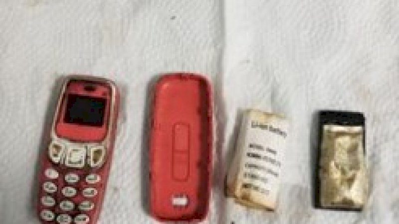 Cara Pria Telan Ponsel Nokia 3310 Bikin Penasaran, Dokter Keluarkan Utuh Tanpa Sayatan