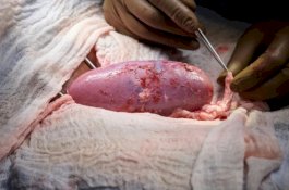 Tim Dokter di AS Transplantasi Ginjal Babi ke Manusia, Begini Hasilnya