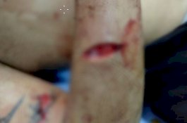 Pria Tewas di Daya Ditemukan Banyak Luka Sayatan, Keluarga Minta Polisi Usus Tuntas