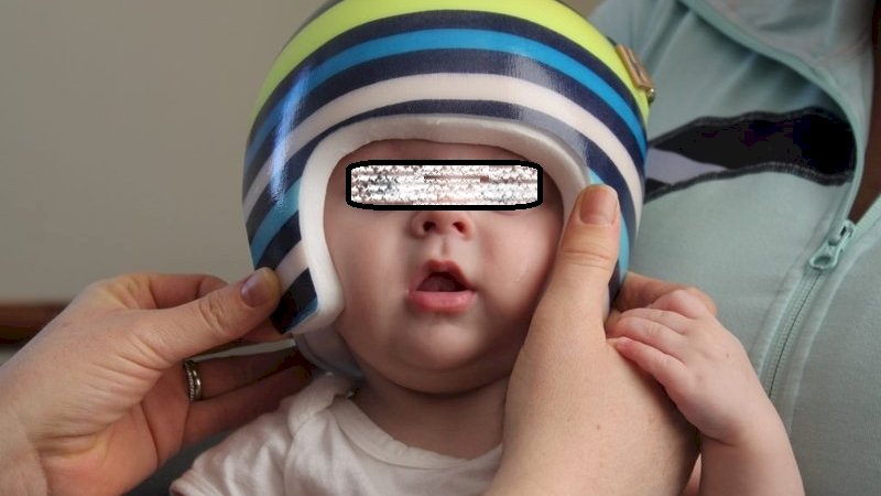 Orang Tua di China Pakaikan Helm untuk Bayinya agar Kepalanya Berbentuk Bulat
