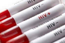 Ilmuwan Temukan Varian HIV Baru, Lebih Menular dan Cepat Jadi AIDS