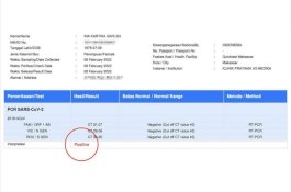 Ketua DPRD Sulsel Terkonfirmasi Positif Covid-19