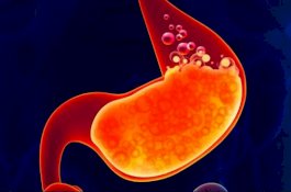 Gejala, Penyebab, dan Diagnosis Penyakit Asam Lambung