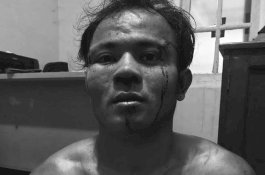 Tampang Pemuda yang Tega Potong Leher Ayahnya hingga Putus