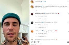 Justin Bieber Alami Lumpuh Wajah, Tak Bisa Berkedip dan Tersenyum