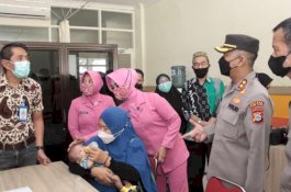 Polres Parepare Gandeng RSUD Andi Makkasau Gelar Operasi Bibir Sumbing Gratis